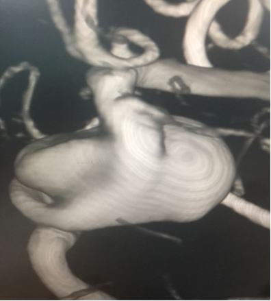 image.png image.png